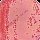 Cultivated anaerobic Klebsiella pneumoniae bacteria. Image: CDC